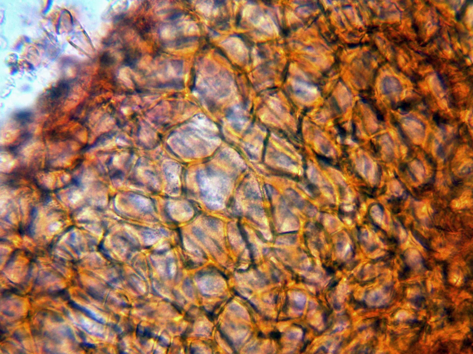 Microscopía de Nectria cinnabarina - 10 - Peridio-001